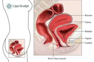 Treatment For A Leaky Bladder 2 How EM Chair treatment Maldon can help Leaky bladder issues. Read more now!